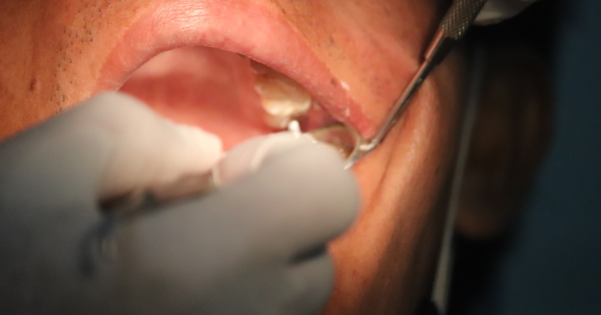 Схематичное изображение связи между положением языка, дыхательными путями и здоровьем полости рта